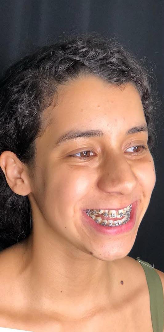Antes do caso 1