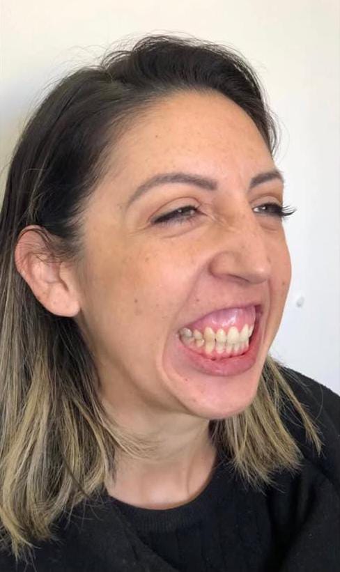 Antes do caso 3