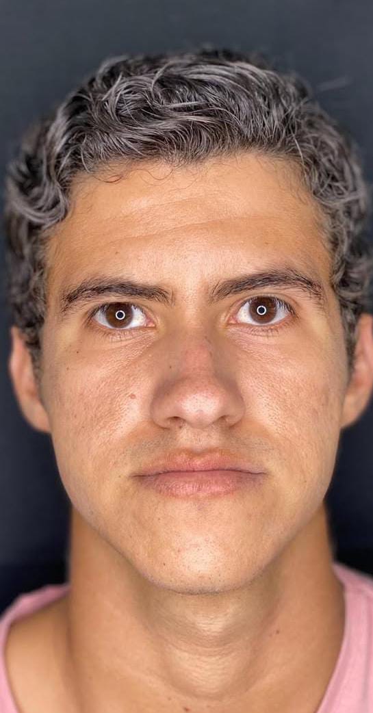 Antes do caso 5